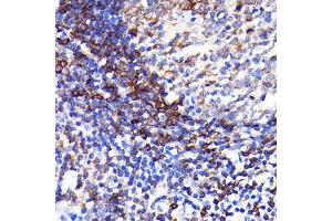Immunohistochemistry of paraffin-embedded human appendix using SHP1 Rabbit mAb (ABIN7269716) at dilution of 1:100 (40x lens). (SHP1 antibody)