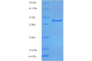 SDS-PAGE (SDS) image for Golgi SNAP Receptor Complex Member 2 (GOSR2) (AA 1-190) protein (His-SUMO Tag) (ABIN5709603)