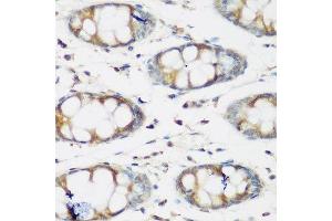 Immunohistochemistry of paraffin-embedded human colon using BMP2 antibody. (BMP2 antibody  (AA 283-396))
