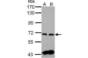 WB Image Sample (30 ug of whole cell lysate) A: PC-3 B: U87-MG 7.