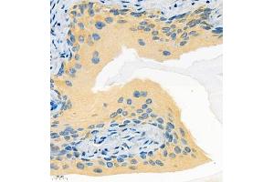 Immunohistochemistry of paraffin embedded mouse bladder using Tnfaip2 (ABIN7076074) at dilution of 1:600 (400x lens) (TNFAIP2 antibody)