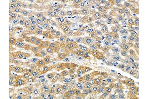 ABIN6261741 and ABIN6266901 at 1/100 staining Mouse brain tissue by IHC-P.