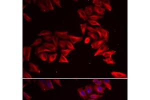 Immunofluorescence analysis of HeLa cells using SFRP4 Polyclonal Antibody (SFRP4 antibody)