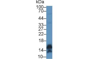 Western blot analysis of Human A431 cell lysate, using Human CALML5 Antibody (1 µg/ml) and HRP-conjugated Goat Anti-Rabbit antibody ( (CALML5 antibody  (AA 1-146))