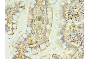 Immunohistochemistry of paraffin-embedded human small intestine tissue using ABIN7145650 at dilution of 1:100 (BRINP2 antibody  (AA 34-300))