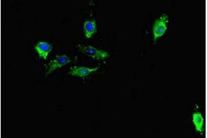 TDRD1 antibody  (AA 12-314)