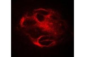Immunofluorescent analysis of RBAT staining in Hela cells. (SLC3A1 antibody)
