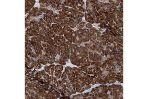 Immunohistochemical staining of human pancreas with UFL1 polyclonal antibody  shows strong cytoplasmic positivity in exocrine glandular cells at 1:20-1:50 dilution.
