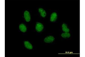 Immunofluorescence of purified MaxPab antibody to NSMCE1 on HeLa cell.