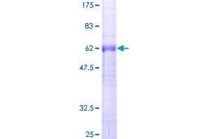 Katanin p80 Subunit B-Like 1 (KATNBL1) (AA 1-304) protein (GST tag)