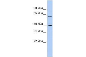 Human THP-1; WB Suggested Anti-TRIM26 Antibody Titration: 0.