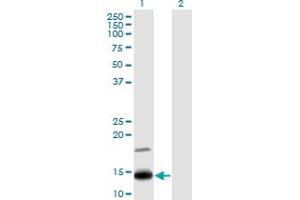 Western Blot analysis of IFITM2 expression in transfected 293T cell line by IFITM2 monoclonal antibody (M14), clone 1F2. (IFITM2 antibody  (AA 1-59))