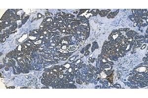 IHC analysis of GABARAP using anti-GABARAP antibody (ABIN7603159). (GABARAP antibody  (N-Term))