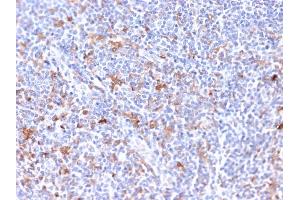 Formalin-fixed, paraffin-embedded human Tonsil stained with RCAS1 Mouse Monoclonal Antibody (CPTC-EBAG9-2). (RCAS1 antibody)