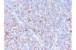 Formalin-fixed, paraffin-embedded human Tonsil stained with RCAS1 Mouse Monoclonal Antibody (CPTC-EBAG9-2).
