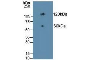 Detection of CDH17 in Mouse Colon Tissue using Polyclonal Antibody to Cadherin 17 (CDH17) (LI Cadherin antibody  (AA 67-351))