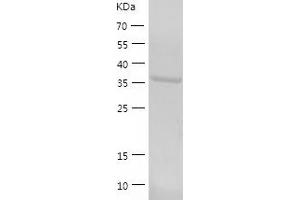 Western Blotting (WB) image for RNA terminal Phosphate Cyclase Domain 1 (RTCD1) (AA 1-366) protein (His tag) (ABIN7124931)