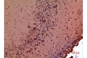 Immunohistochemistry (IHC) analysis of paraffin-embedded Mouse Brain, antibody was diluted at 1:100. (GDF5 antibody  (Internal Region))