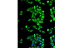 Immunofluorescence analysis of MCF7 cells using ANTXR1 Polyclonal Antibody (ANTXR1 antibody)