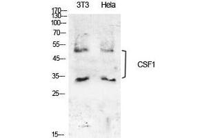 Western Blotting (WB) image for anti-Colony Stimulating Factor 1 (Macrophage) (CSF1) (Internal Region) antibody (ABIN6285604)