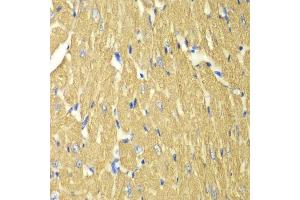 Immunohistochemistry of paraffin-embedded mouse heart using TPM3 antibody. (TPM3 antibody  (AA 1-284))