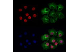 ABIN6264887 and ABIN6276947 staining Hela cells by IF/ICC. (RUVBL2 antibody  (Internal Region))