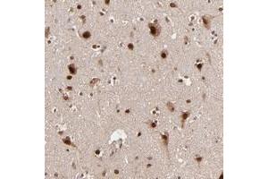 Immunohistochemical staining of human cerebral cortex with TOP1MT polyclonal antibody  shows strong nuclear and cytoplasmic positivity in neuronal cells. (TOP1MT antibody)
