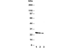 Western blot testing of Growth Hormone antibody and Lane 1:  Recombinant rat GH protein 10ng;  2: 5ng;  3: 2.