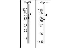 Image no. 1 for anti-MAP/microtubule Affinity-Regulating Kinase 2 (MARK2) (C-Term) antibody (ABIN360425) (MARK2 antibody  (C-Term))