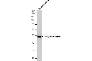 AGT antibody