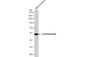 WB Image Mouse tissue extract (50 μg) was separated by 10% SDS-PAGE, and the membrane was blotted with Angiotensinogen antibody [N1C3] , diluted at 1:1000.