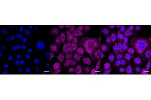 Immunocytochemical staining of HT- cells with Retinoic acid receptor alpha antibody (ABIN7800189), 1:1,000).