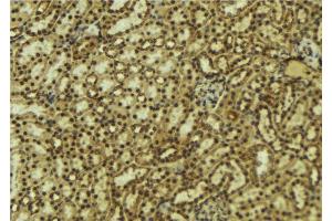 ABIN6277519 at 1/100 staining Mouse kidney tissue by IHC-P. (PRKACB antibody  (C-Term))