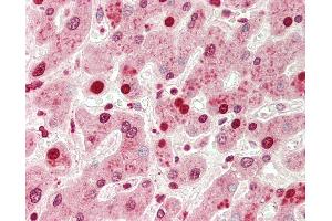 Human Liver: Formalin-Fixed, Paraffin-Embedded (FFPE)