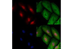 ABIN6257451 and ABIN6273495 staining  cells by IF/ICC. (RAD1 antibody  (Internal Region))