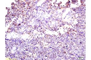 Formalin-fixed and paraffin embedded mouse spleen labeled with Rabbit Anti phospho-DAB2 (Ser24) Polyclonal Antibody, Unconjugated (ABIN1386225) at 1:200 followed by conjugation to the secondary antibody and DAB staining (DAB2 antibody  (pSer24))