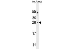 Western Blotting (WB) image for anti-Ornithine Decarboxylase Antizyme 2 (OAZ2) antibody (ABIN2995828)