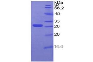 SDS-PAGE of Protein Standard from the Kit  (Highly purified E. (IGFBP4 ELISA Kit)