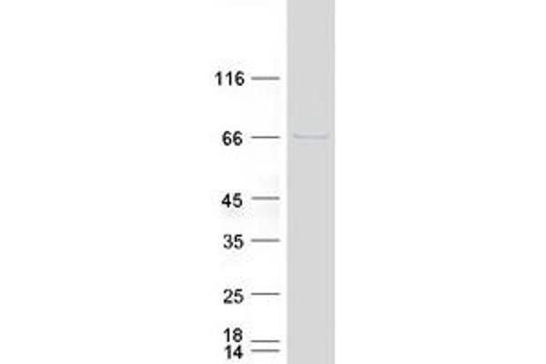 GALNT6 Protein (Myc-DYKDDDDK Tag)