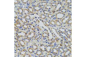 Immunohistochemistry of paraffin-embedded rat kidney using TRMT2A antibody. (TRMT2A antibody)