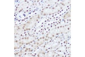 Immunohistochemistry of paraffin-embedded mouse kidney using S Rabbit pAb (ABIN6132631, ABIN6147390, ABIN6147391 and ABIN6224669) at dilution of 1:100 (40x lens). (SART1 antibody  (AA 1-255))