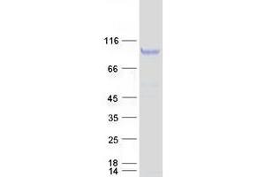 TCTN2 Protein (Transcript Variant 1) (Myc-DYKDDDDK Tag)