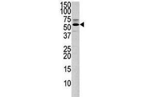 Western blot analysis of PTEN antibody and 293 lysate. (PTEN antibody  (AA 371-403))
