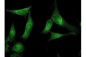 Immunocytochemistry/Immunofluorescence analysis using Rat Anti-Aha1 Monoclonal Antibody, Clone 25F2. (AHSA1 antibody)