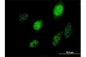 Immunofluorescence of purified MaxPab antibody to SCML1 on HeLa cell. (SCML1 antibody  (AA 1-208))
