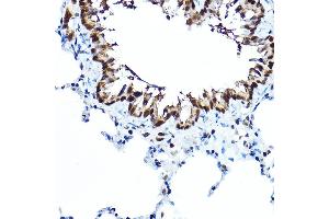 Immunohistochemistry of paraffin-embedded rat lung using FOX Rabbit pAb (5278) at dilution of 1:100 (40x lens). (FOXA1 antibody  (AA 263-472))