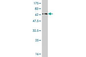 Western Blot detection against Immunogen (59. (ZNF215 antibody  (AA 1-304))