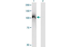 Western Blot analysis of CBL expression in transfected 293T cell line by CBL monoclonal antibody (M01), clone 6D12. (CBL antibody  (AA 736-835))