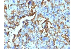 Image no. 3 for anti-Major Histocompatibility Complex, Class II, DR beta 1 (HLA-DRB1) antibody (ABIN6186381) (HLA-DRB1 antibody)
