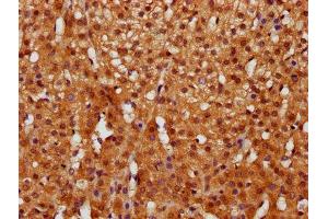 IHC image of ABIN7153551 diluted at 1:400 and staining in paraffin-embedded human adrenal gland tissue performed on a Leica BondTM system. (GGCT antibody  (AA 54-188))